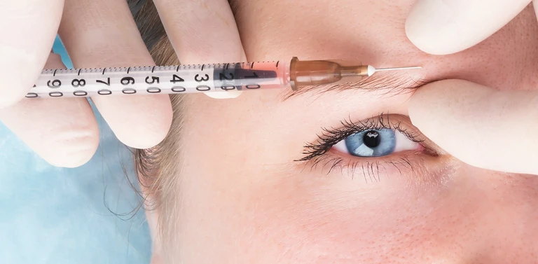 wstrzykiwanie kwasu hialurynowego nad okiem