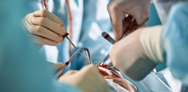 chirurgia szczękowa