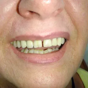 pacjent-1-stomatologia-estetyczna-2