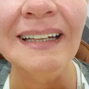 pacjent-1-stomatologia-estetyczna-3