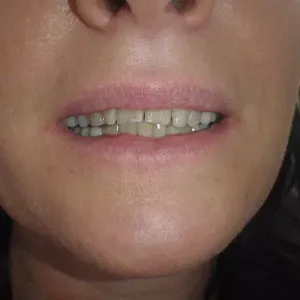 pacjent-2-stomatologia-estetyczna-3