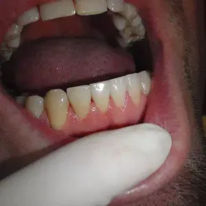 pacjent-3-stomatologia-estetyczna-1