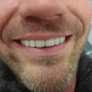 pacjent-3-stomatologia-estetyczna-2